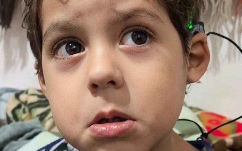Menino de 3 anos ouve pela primeira vez após cirurgia de implante coclear