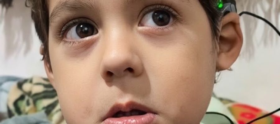 Menino de 3 anos ouve pela primeira vez após cirurgia de implante coclear